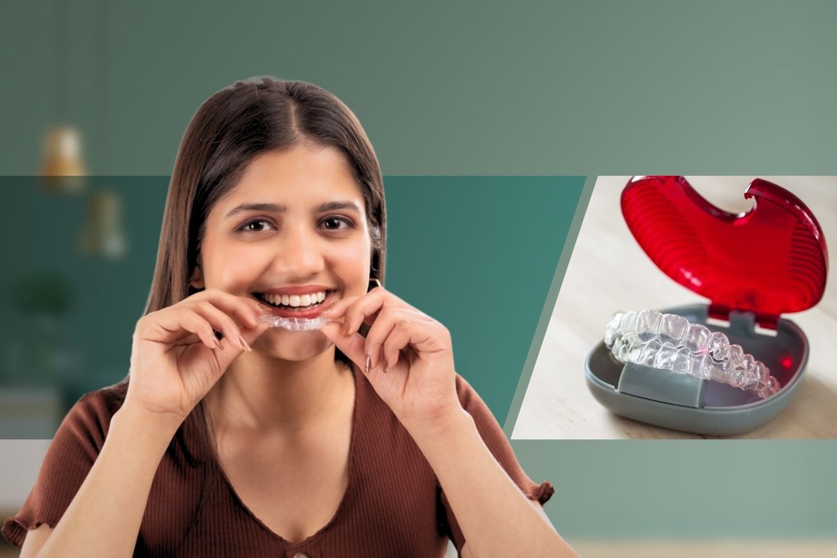Aligner
