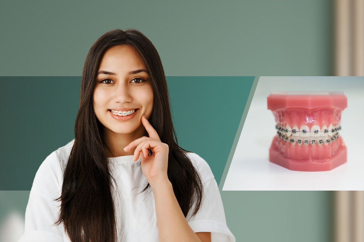 Braces Treatment