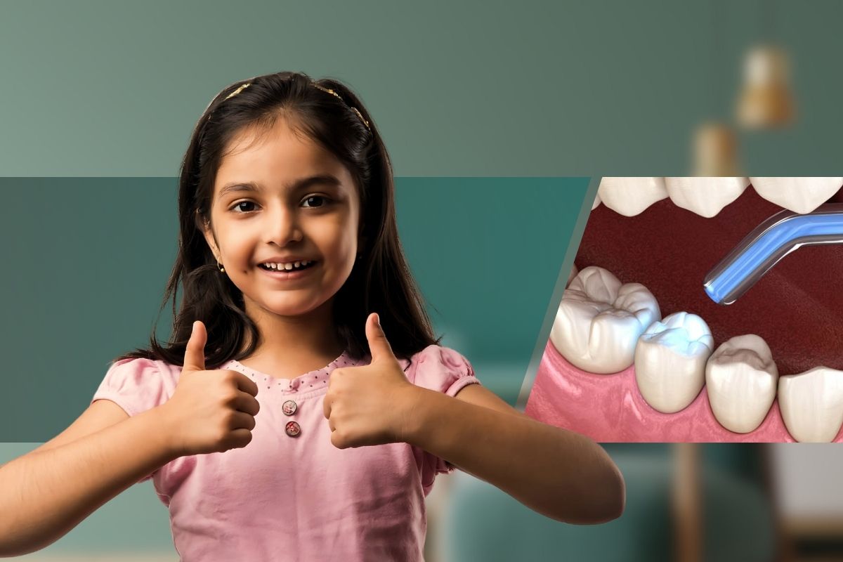 Cavity Filling | Tooth colored filling 
