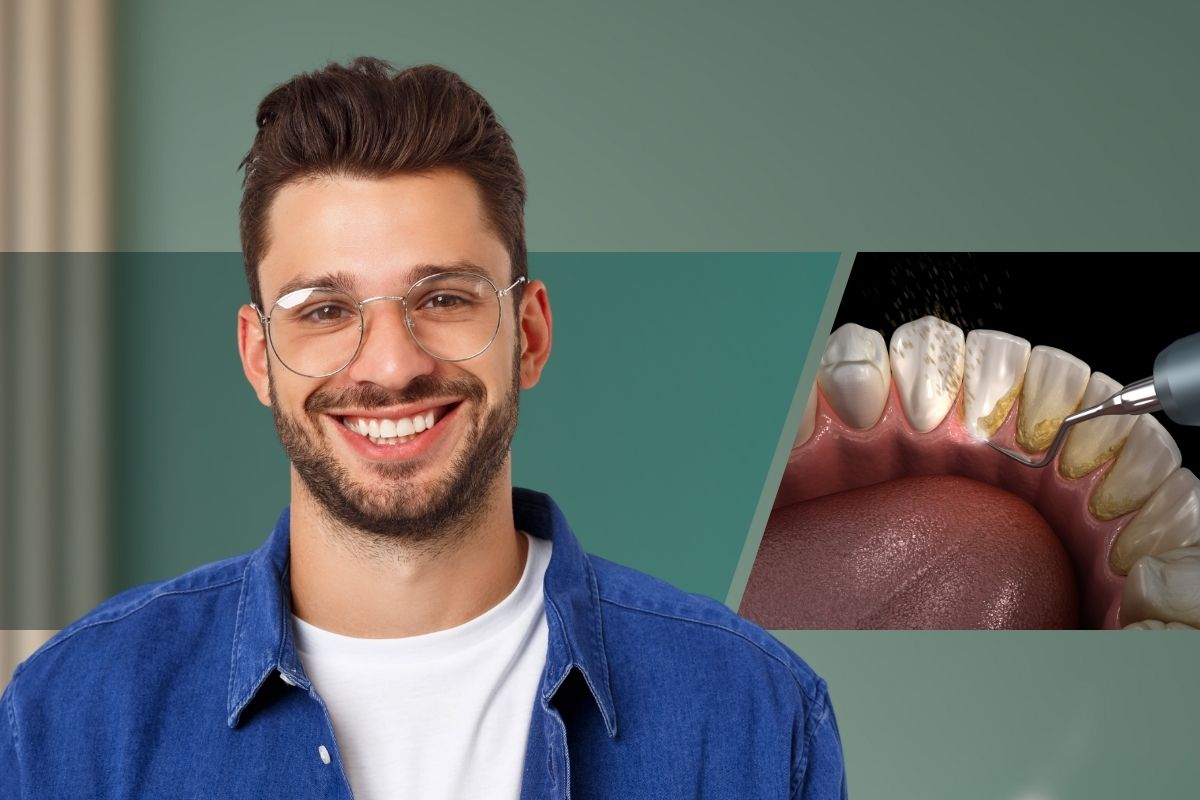 Teeth Cleaning 
