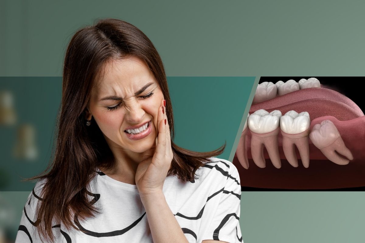 Wisdom Tooth Extraction