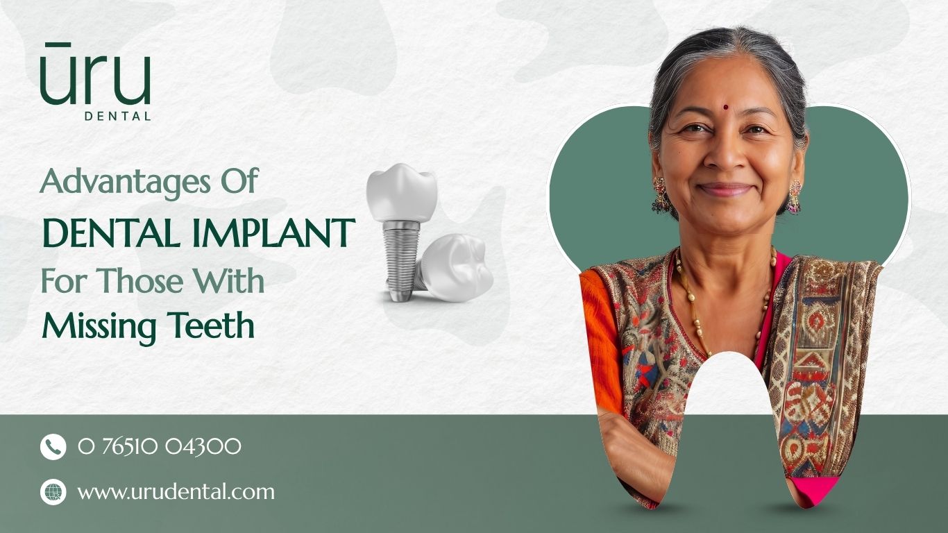 Advantages of Dental Implant for those with Missing teeth
