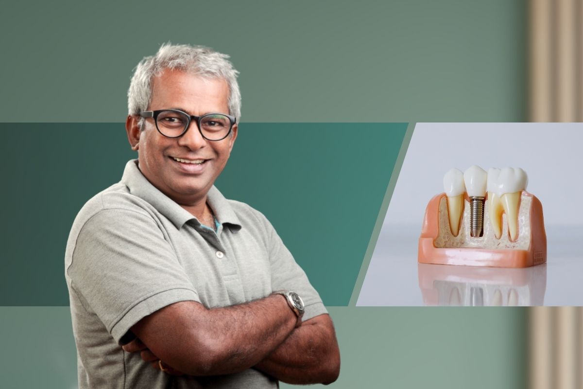 Dental Implants