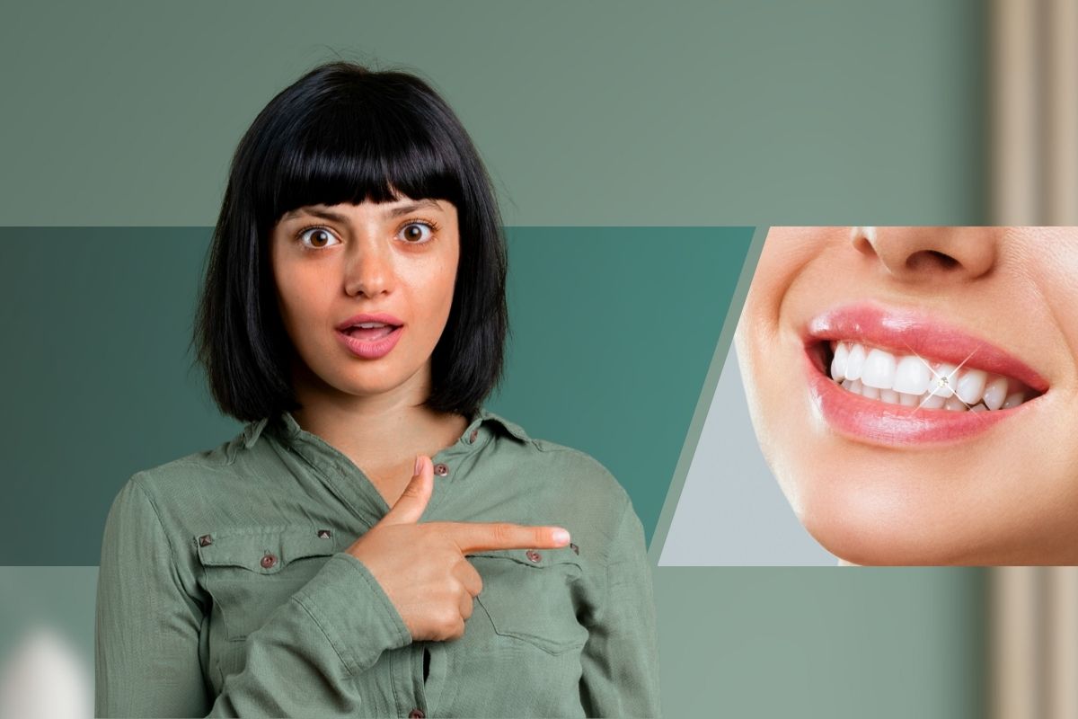 Dental Jewellery in HSR Layout, Bangalore