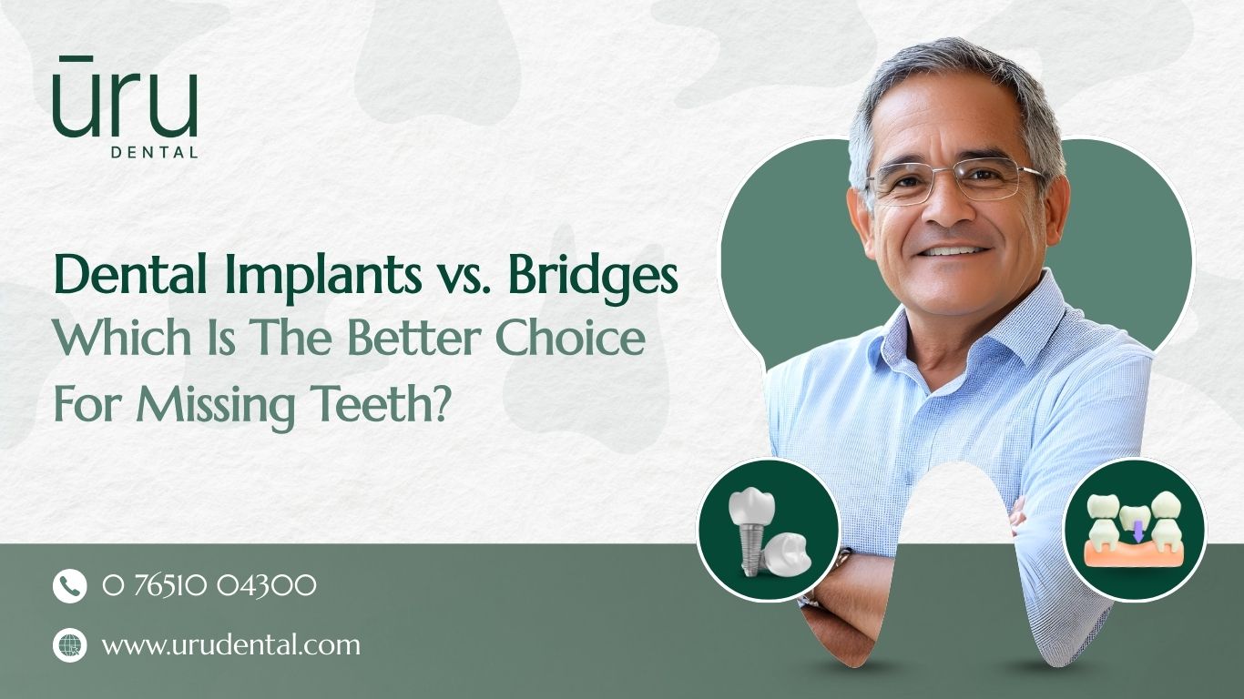 Dental Implants vs. Bridges: Which Is the Better Choice for Missing Teeth?