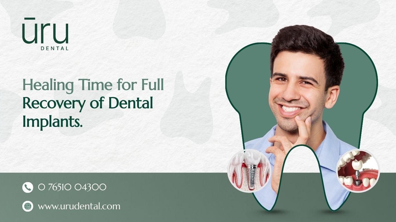Healing Time for Full Recovery of Dental Implant