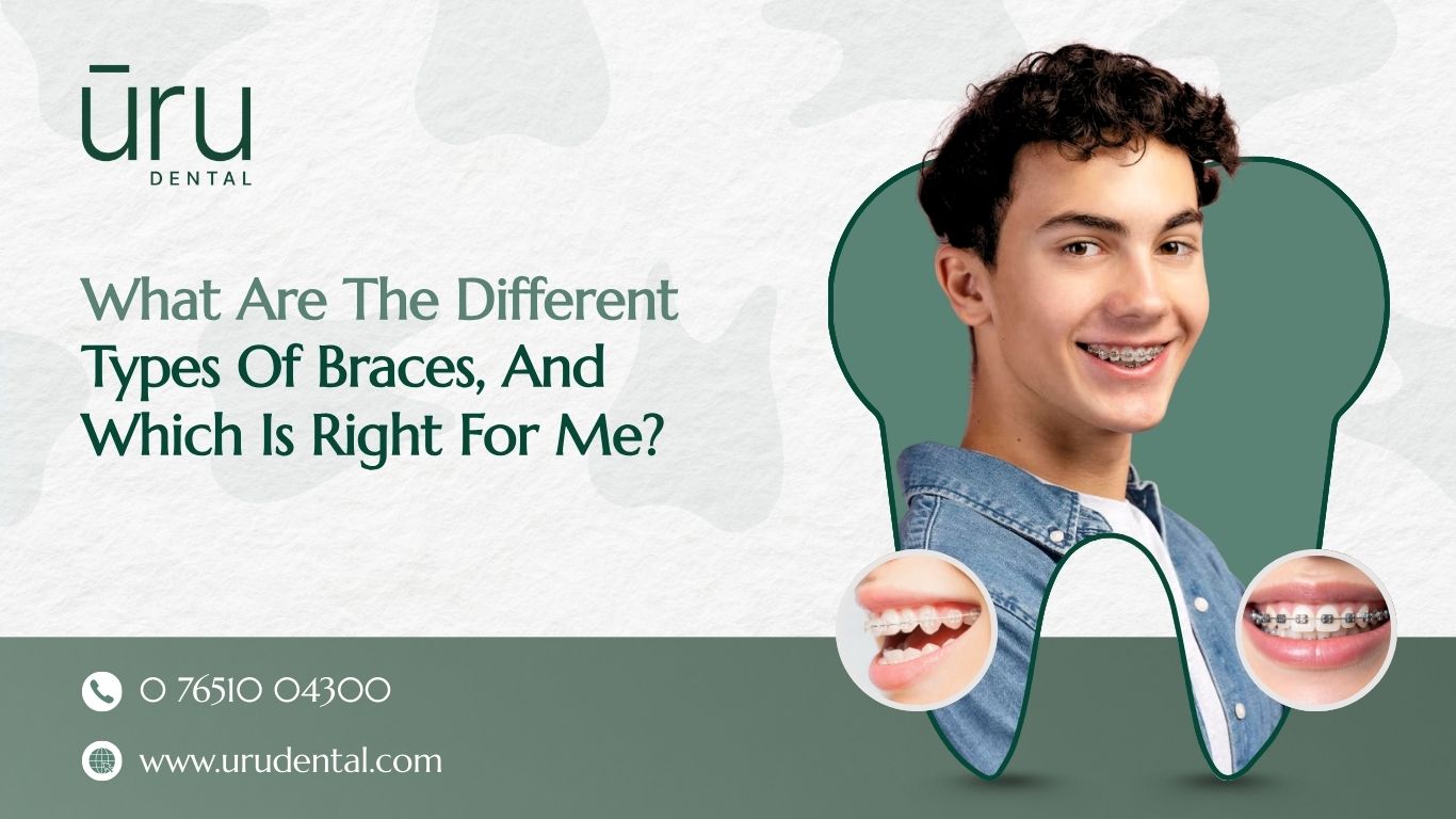 What Are The Different Types Of Braces, and Which Is Right for Me?